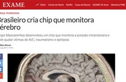 <h6><a href="http://v48x8x4zc88.c.updraftclone.com/wp-content/uploads/2022/02/Brasileiro-cria-chip-que-monitora-cerebro-_-Exame.pdf">Brasileiro cria chip que monitora cérebro</a></h6><p><a href="http://v48x8x4zc88.c.updraftclone.com/wp-content/uploads/2022/02/Brasileiro-cria-chip-que-monitora-cerebro-_-Exame.pdf" target="_blank" rel="noopener">Revista Exame</a></p>
