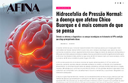 <h6><a href="https://afinamenina.com.br/2025/06/04/hidrocefalia-de-pressao-normal-a-doenca-que-afetou-chico-buarque-e-e-mais-comum-do-que-se-pensa/#google_vignette" target="_blank" rel="noopener">hidrocefalia de pressão normal: a doença que afetou Chico Buarque e é mais comum do que se pensa</a></h6><p><a href="https://afinamenina.com.br/2025/06/04/hidrocefalia-de-pressao-normal-a-doenca-que-afetou-chico-buarque-e-e-mais-comum-do-que-se-pensa/#google_vignette" target="_blank" rel="noopener">Afina Menina</a></p>